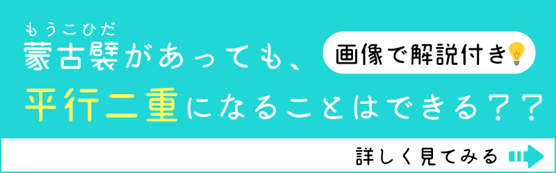 Chel-チェルアイズ- 蒙古襞 平行二重