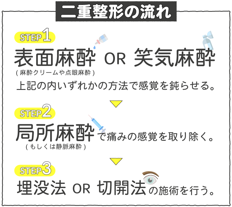 STEP1表面麻酔or笑気麻酔、STEP2局所麻酔、STEP3埋没法or切開法の施術